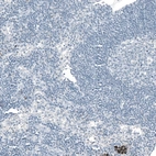 Immunohistochemical staining of human lymph node shows no positivity in lymphoid cells as expected.