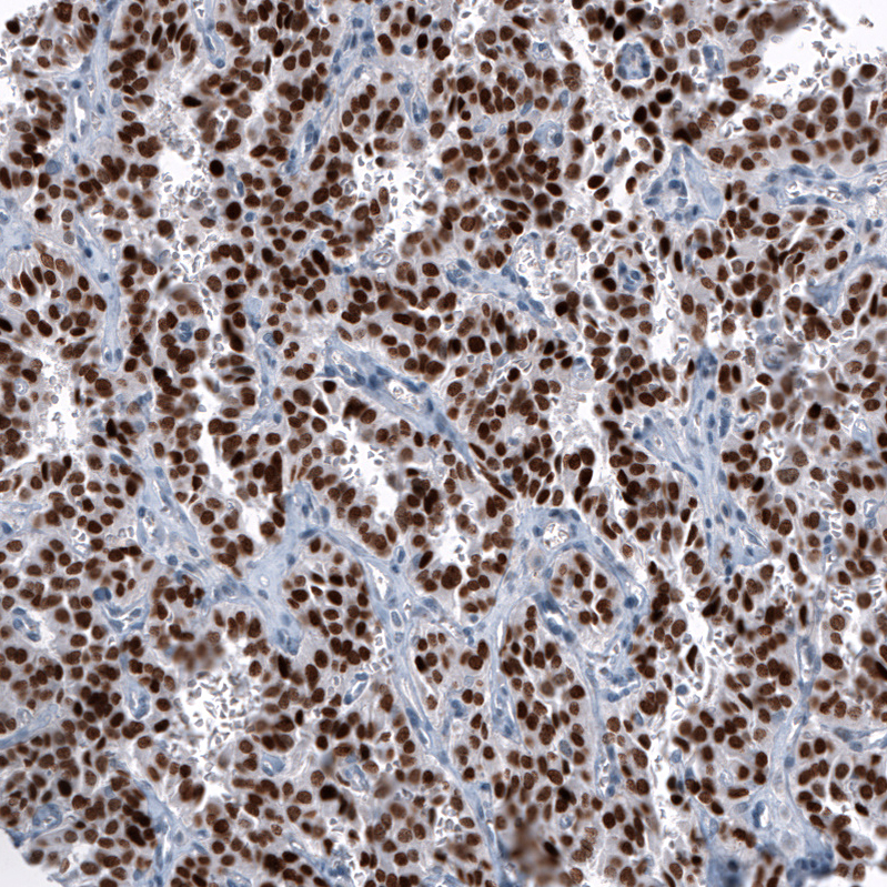Anti-OTP Antibody
