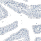 Immunohistochemical staining of human fallopian tube shows no positivity in glandular cells as expected.