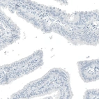 Immunohistochemical staining of human fallopian tube shows no positivity in glandular cells as expected.
