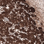 Immunohistochemical staining of human Adrenal gland shows strong cytoplasmic positivity in neuroendocrine cells.