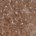 Anti-CHGB Antibody