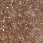 Immunohistochemical staining of human Cerebral cortex shows strong cytoplasmic positivity in neuropil.