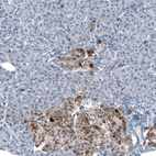 Immunohistochemical staining of human Pancreas shows moderate cytoplasmic positivity in islets of Langerhans.