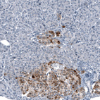 Anti-CHGB Antibody