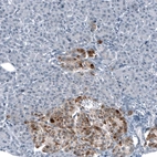 Immunohistochemical staining of human Pancreas shows moderate cytoplasmic positivity in islets of Langerhans.