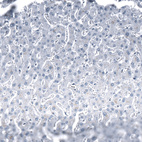 Anti-CHGB Antibody