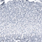 Immunohistochemical staining of human Liver shows no positivity in hepatocytes as expected.