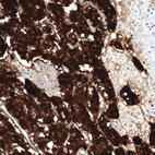 Immunohistochemical staining of human adrenal gland shows strong cytoplasmic positivity in neuroendocrine cells.
