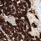 Anti-CHGB Antibody