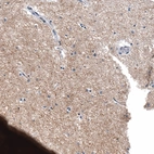 Immunohistochemical staining of human cerebral cortex shows moderate cytoplasmic positivity in neuropil.