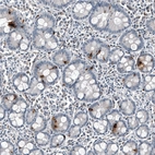 Immunohistochemical staining of human duodenum shows moderate cytoplasmic positivity in glandular cells.