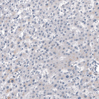 Immunohistochemical staining of human liver shows no positivity in hepatocytes as expected.