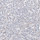 Anti-CHGB Antibody