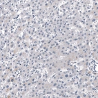 Immunohistochemical staining of human liver shows no positivity in hepatocytes as expected.
