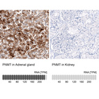 Anti-PNMT Antibody