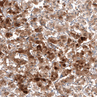 Immunohistochemical staining of human Adrenal gland shows strong cytoplasmic positivity in neuroendocrine cells.