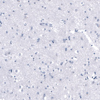 Immunohistochemical staining of human Cerebral cortex shows very weak cytoplasmic positivity in neuronal cells.