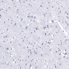 Anti-PNMT Antibody