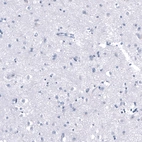 Immunohistochemical staining of human Cerebral cortex shows very weak cytoplasmic positivity in neuronal cells.