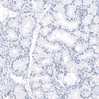 Immunohistochemical staining of human Duodenum shows no positivity in glandular cells as expected.