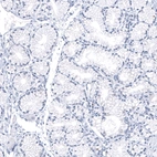 Immunohistochemical staining of human Duodenum shows no positivity in glandular cells as expected.