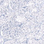 Immunohistochemical staining of human Kidney shows no positivity in cells in seminiferous ducts as expected.