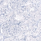 Immunohistochemical staining of human Kidney shows no positivity in cells in seminiferous ducts as expected.