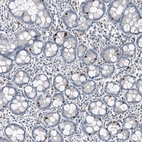Immunohistochemical staining of human duodenum shows strong nuclear positivity in subset of glandular cells.