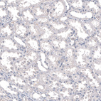 Anti-INSM1 Antibody