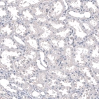 Immunohistochemical staining of human kidney shows no positivity in cells in tubules as expected.