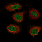 Anti-NF1 Antibody