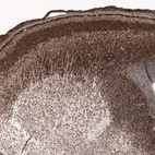 Anti-SOX11 Antibody