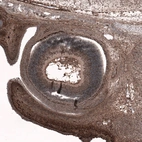 Immunohistochemical staining of eye in mouse embryo E14 retina shows moderate nuclear positivity in developing retina.