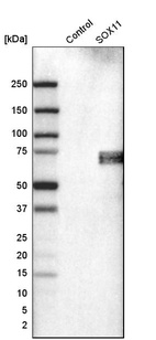 Anti-SOX11 Antibody