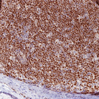 Anti-SOX11 Antibody