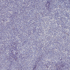 Anti-SOX11 Antibody