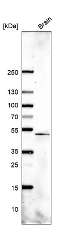 Western blot analysis in human brain tissue.
