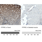 Anti-PTPRC Antibody