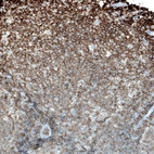 Immunohistochemical staining of human tonsil shows moderate to strong membranous positivity in lymphoid cells.