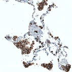 Immunohistochemical staining of human lung shows strong membranous positivity in macrophages.