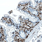 Anti-PTPRC Antibody