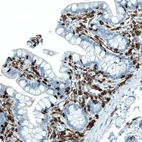 Immunohistochemical staining of human small intestine shows strong membranous positivity in lymphoid cells.