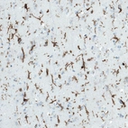 Immunohistochemical staining of human cerebral cortex shows strong positivity in microglia.