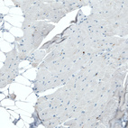 Anti-PTPRC Antibody