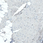 Immunohistochemical staining of human skeletal muscle shows no positivity in myocytes as expected.