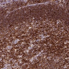 Immunohistochemical staining of human tonsil shows strong membranous positivity in lymphoid cells.