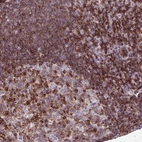 Immunohistochemical staining of human lymph node shows moderate to strong membranous positivity in lymphoid cells.