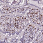Immunohistochemical staining of human duodenum shows moderate membranous positivity in lymphoid cells.