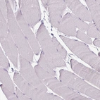 Immunohistochemical staining of human skeletal muscle shows no positivity in myocytes as expected.